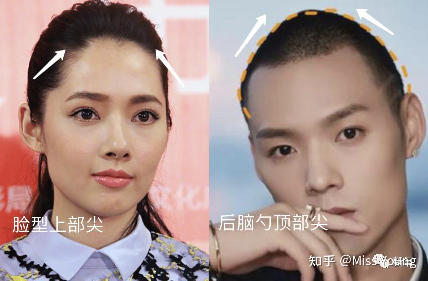 头扁的女明星有哪些