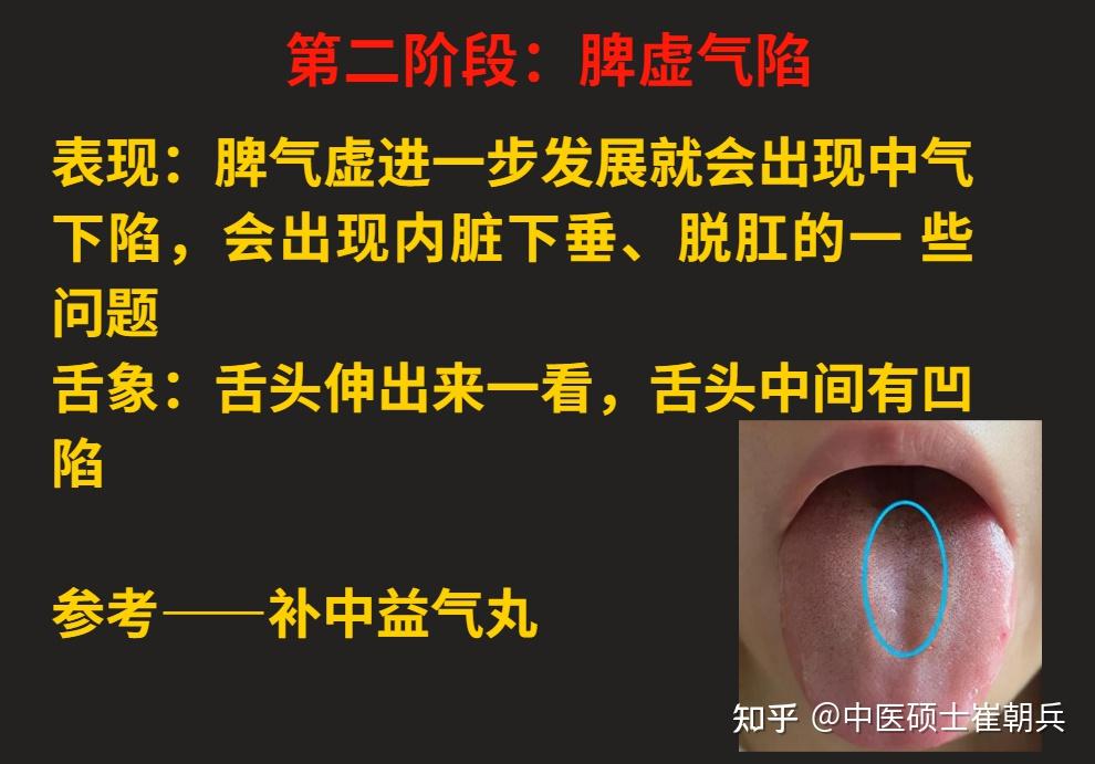 脾气虚、脾阳虚,由轻到重,看看自己的脾虚在哪个阶段?12个阶段的脾虚一次讲明白 - 知乎