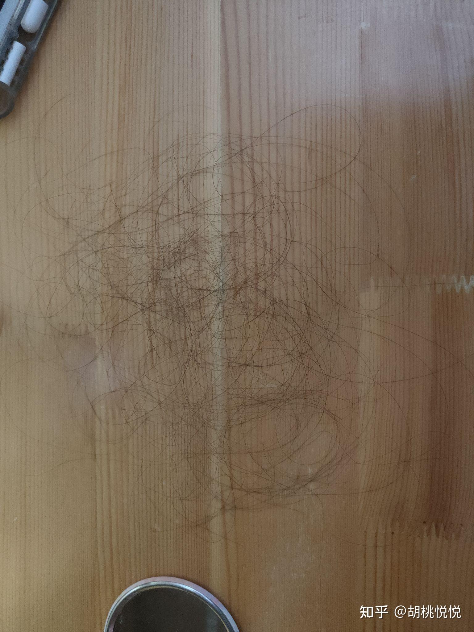 100根头发是多少? - 知乎