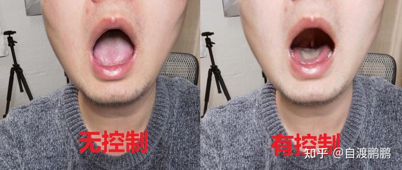 说话很用力就会嗓子疼这是不是声带的问题