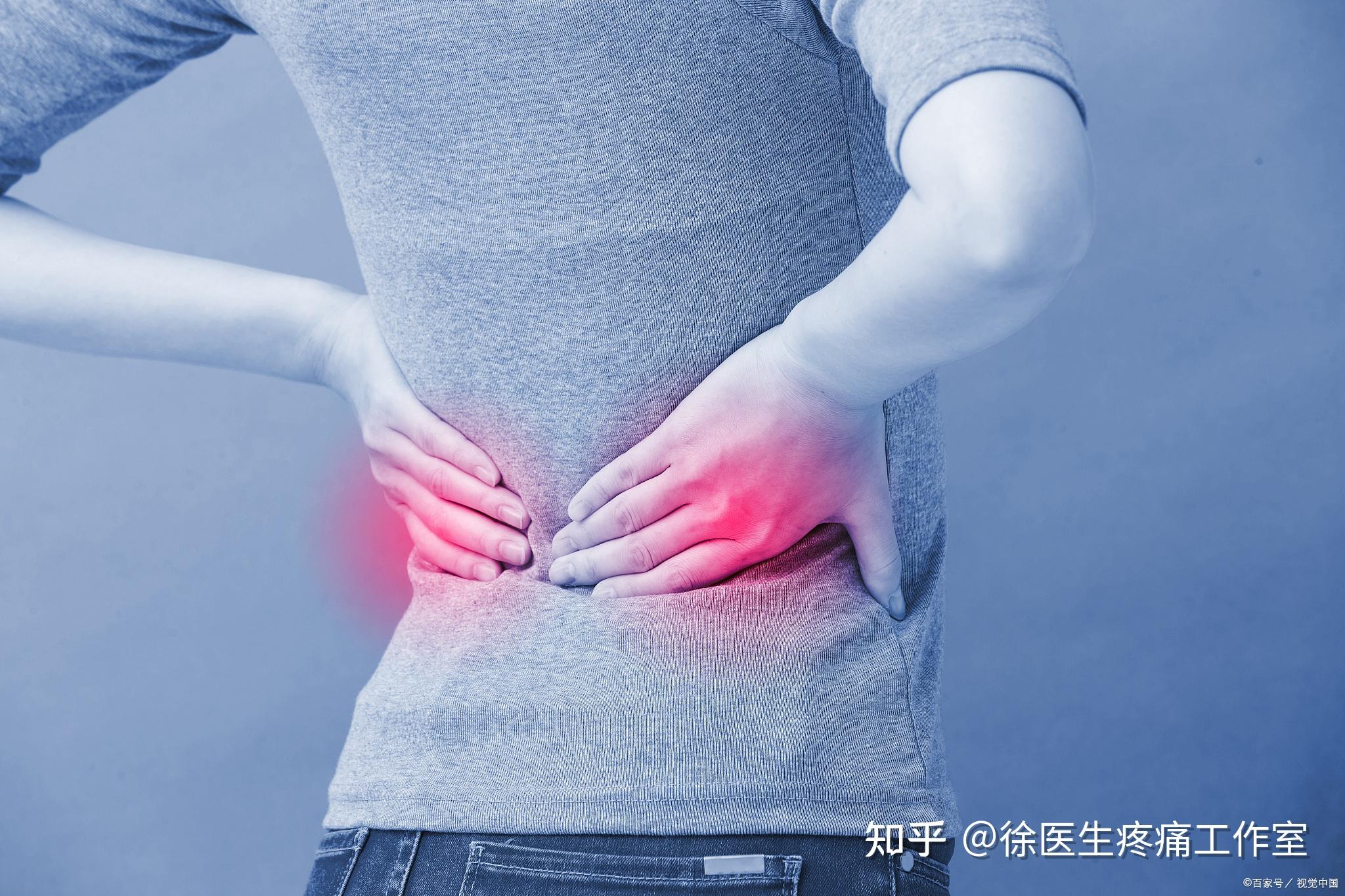 7种常见下背痛位置与原因，教你如何鉴别诊断！ - 知乎