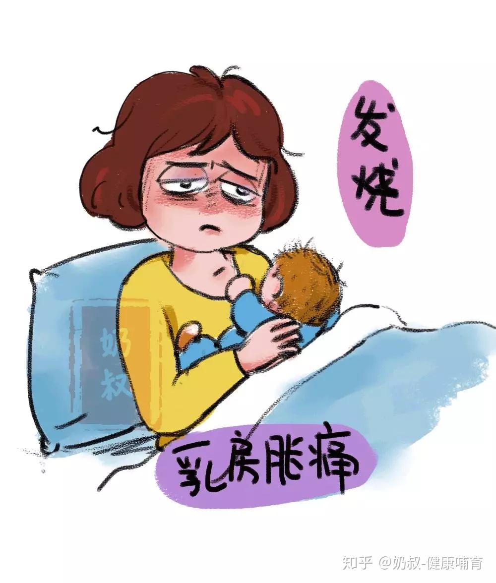 哺乳期得了乳腺炎怎么办? - 知乎