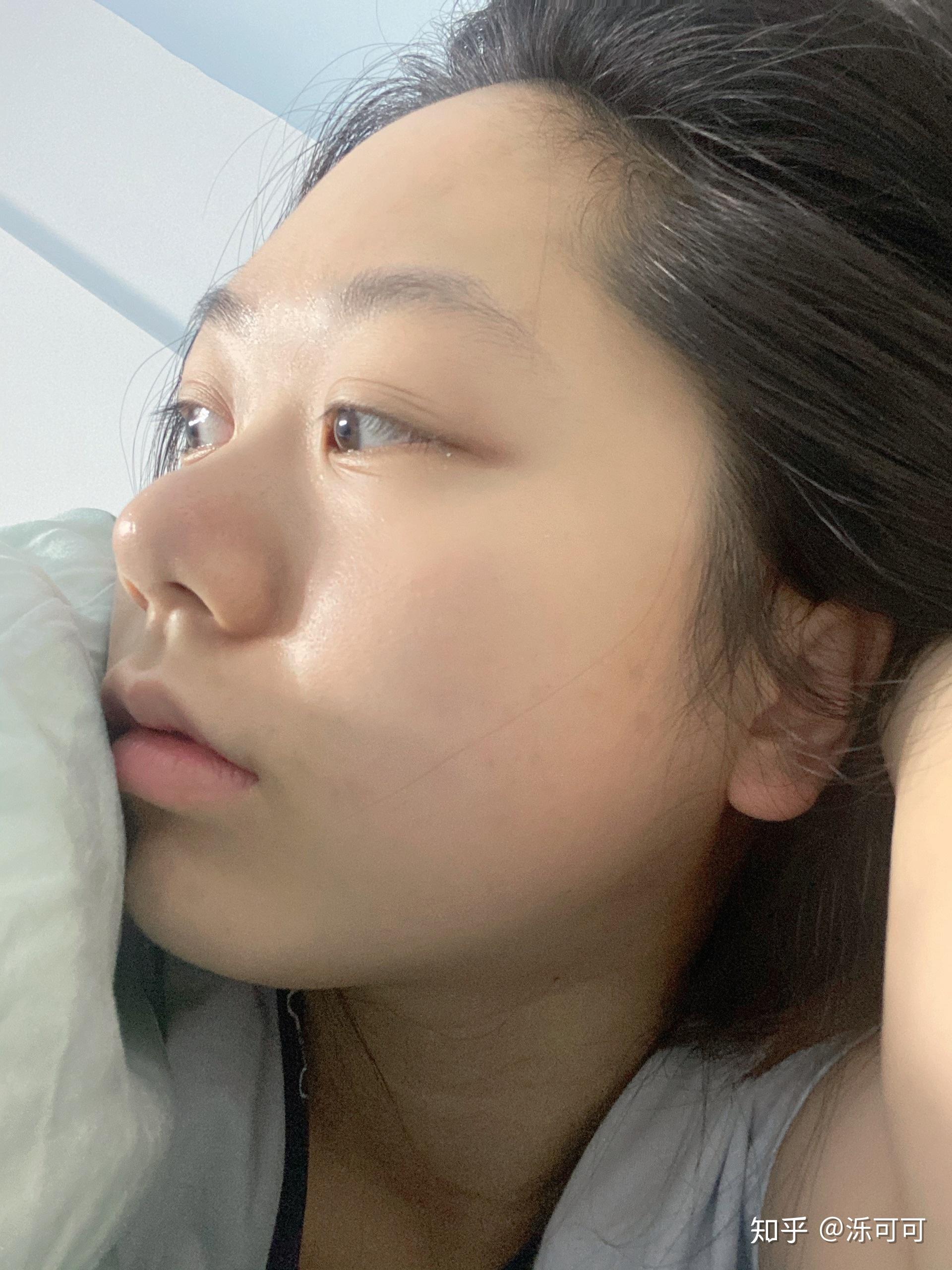 鼻子高但是山根低是什么样? - 知乎