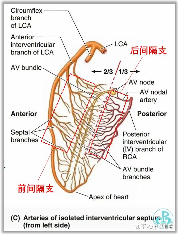 左前降支近段狭窄图片