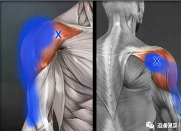 肱三头肌tricepsbrachiiby中医师都医生