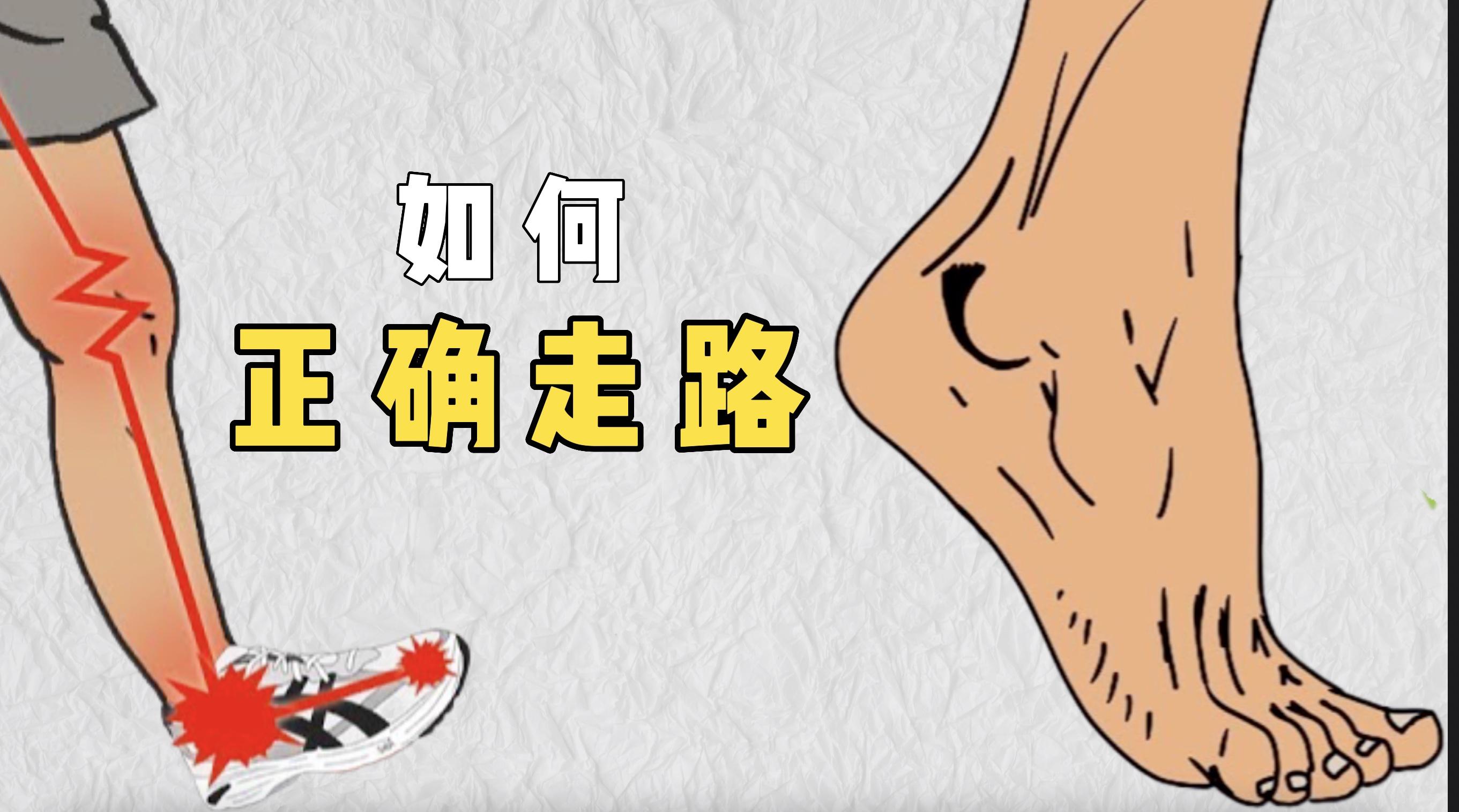 臀中肌无力导致的鸭步步态分析