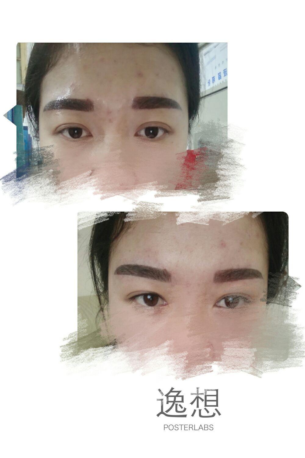 丝雾眉刚做有点粗结痂后会细点吗