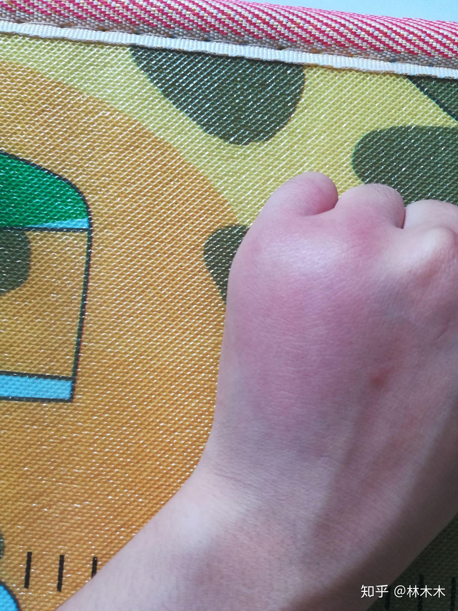 洋辣子有毒吗?被蜇后怎么处理?