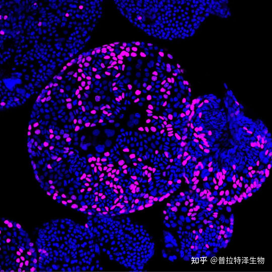 手把手教学｜细胞增殖检测法：EdU染色 - 知乎