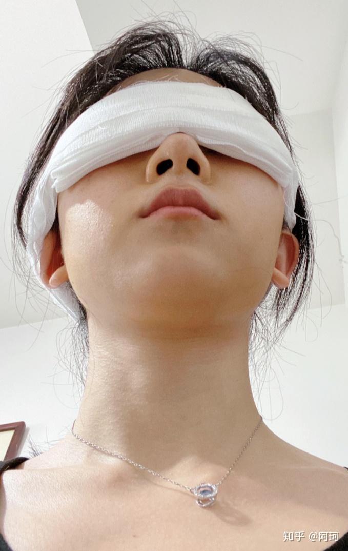 八大處整型醫院患者須知黃牛聯系方式的簡單介紹