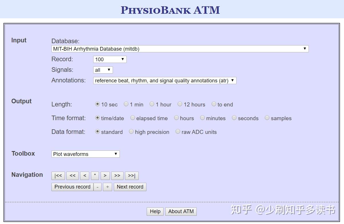 基于机器学习的心律失常分类(二)——读取MIT-BIH数据库中的心电数据[MATLAB] - 知乎