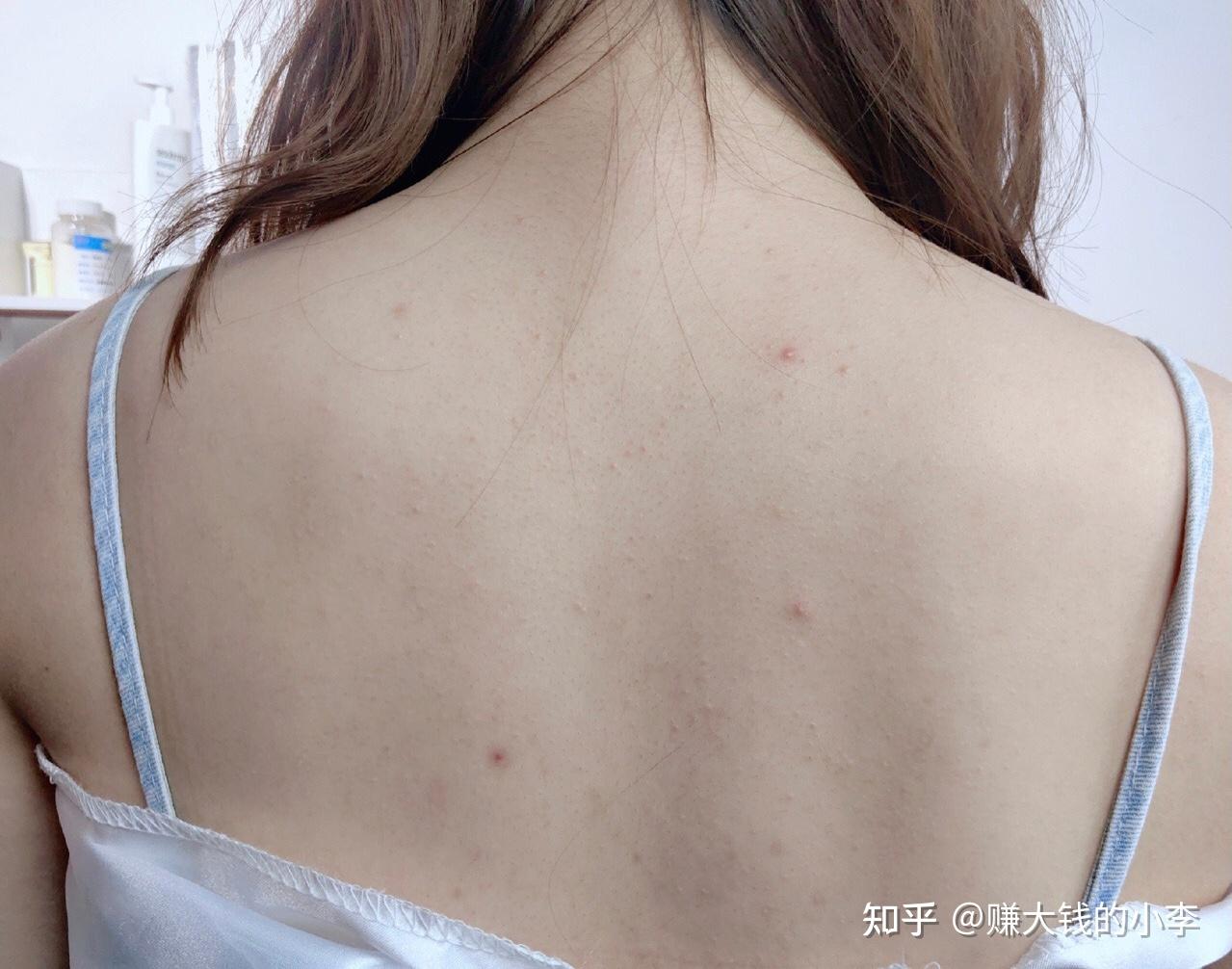 身体乳后背摸不到怎么办(抹身体乳后背摸不到怎么办)