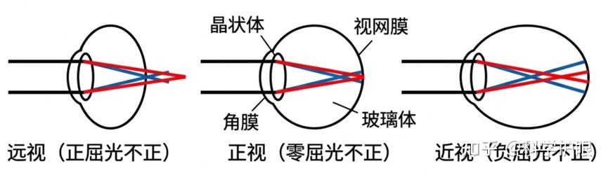 近视防控，只知道望远你就out了（前沿科普） - 知乎