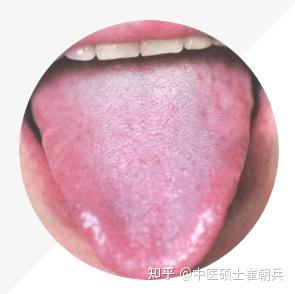 史上最全舌诊图谱!【珍藏版】 - 知乎