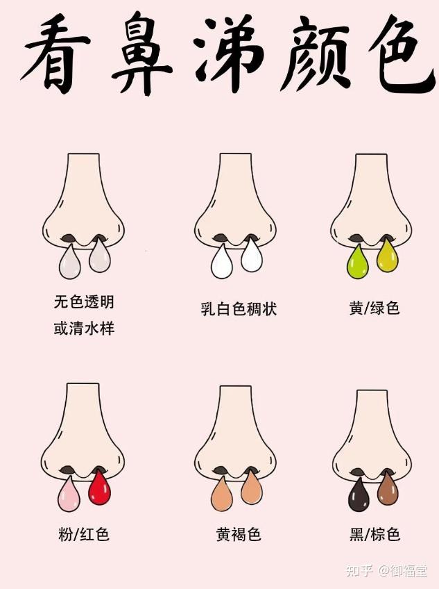 不同颜色的鼻涕,说明了哪些健康问题? - 知乎