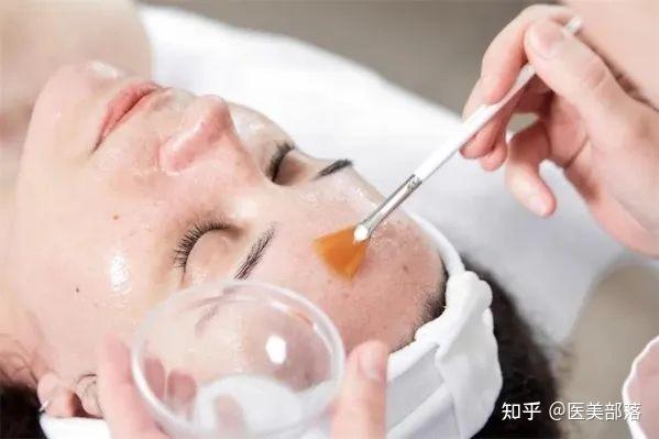 「刷酸」的真相,到底是“焕肤”还是烂脸,请收好这份刷酸指南 - 知乎