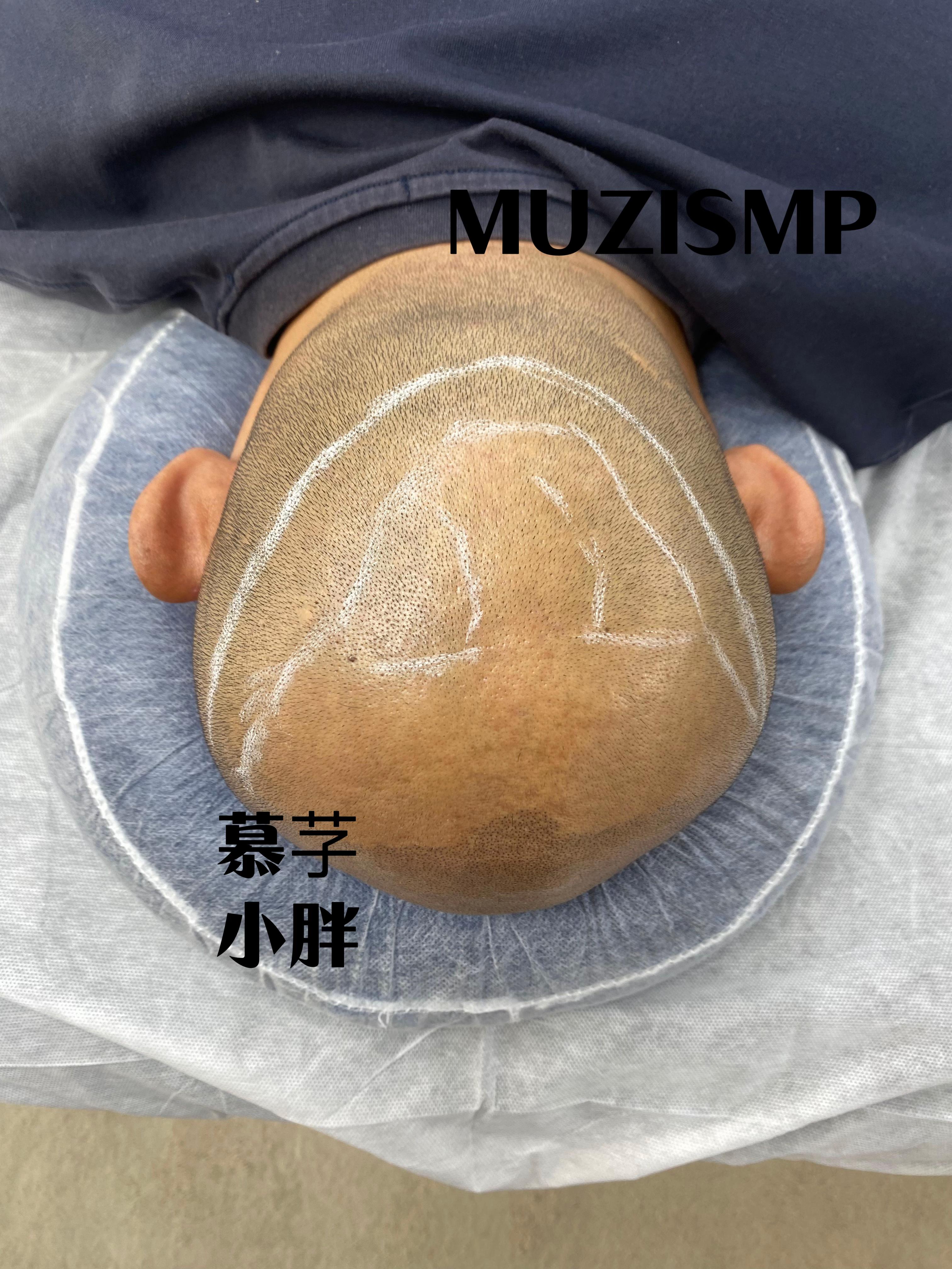 男生光头是种什么体验? - 知乎