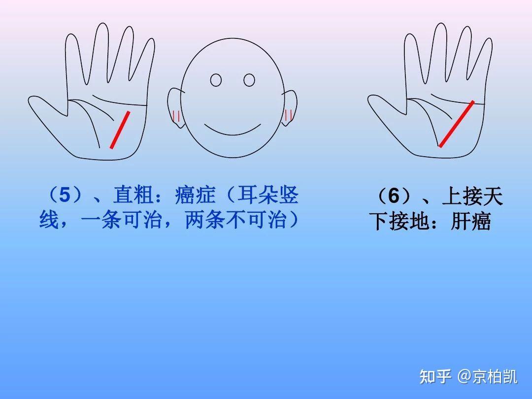 最全手诊图谱（非常实用，建议收藏） - 知乎