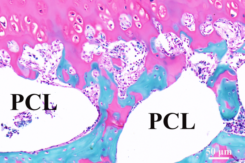 Pcl Human 迈向关节3D打印的未来,《Nature》访上海九院专家 - 知乎