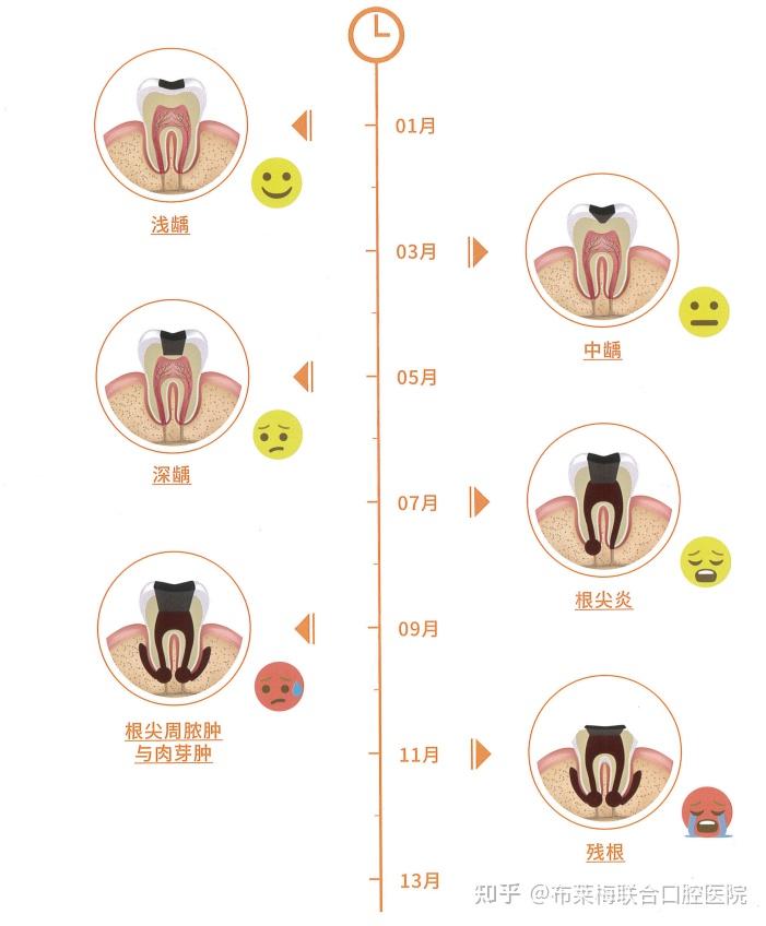 龋齿的发展速度
