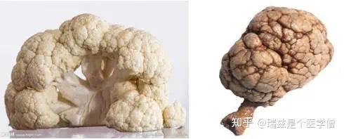 舌尖上的“医学”,你不能错过的“下饭经典” - 知乎
