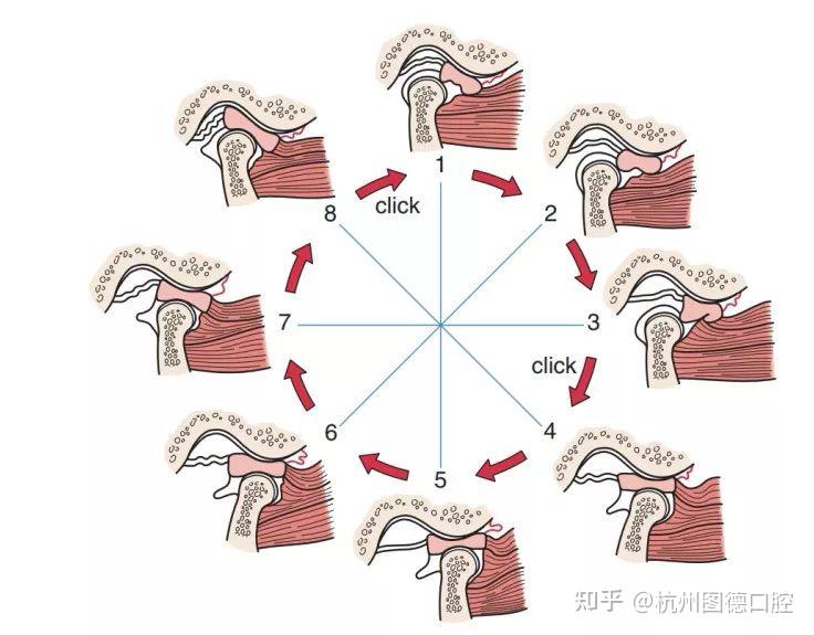 张嘴疼痛、开口受限、开口嘴歪向一侧？你的颞下颌关节病了，看完就明白了！ - 知乎