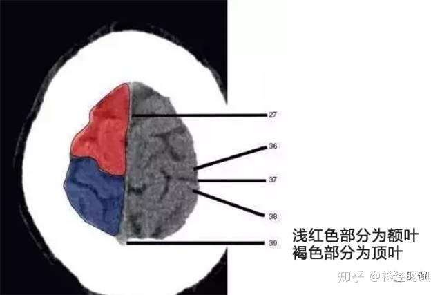 解剖&影像 —— 颅脑CT解剖口诀及彩色解剖图 - 知乎