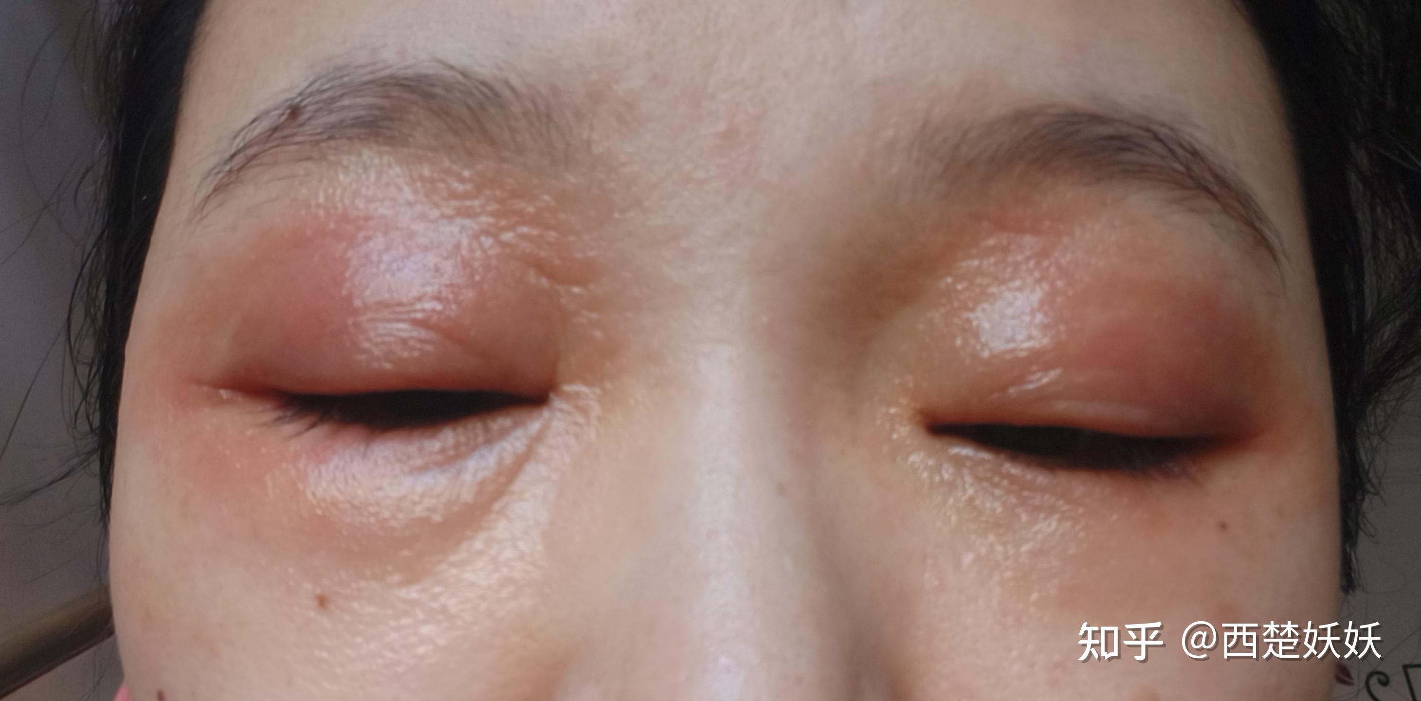 过敏性鼻炎彻底结束,连绵的雨天也终止了,开始一年中我最喜欢的温度