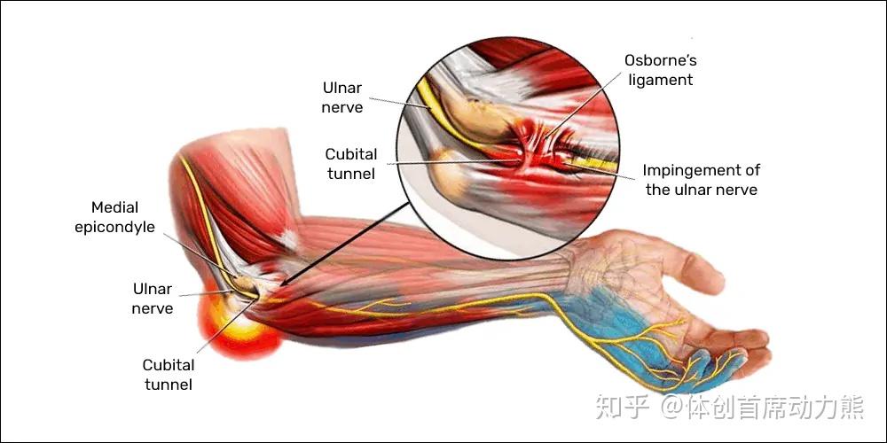 手肘麻筋位置图解图片