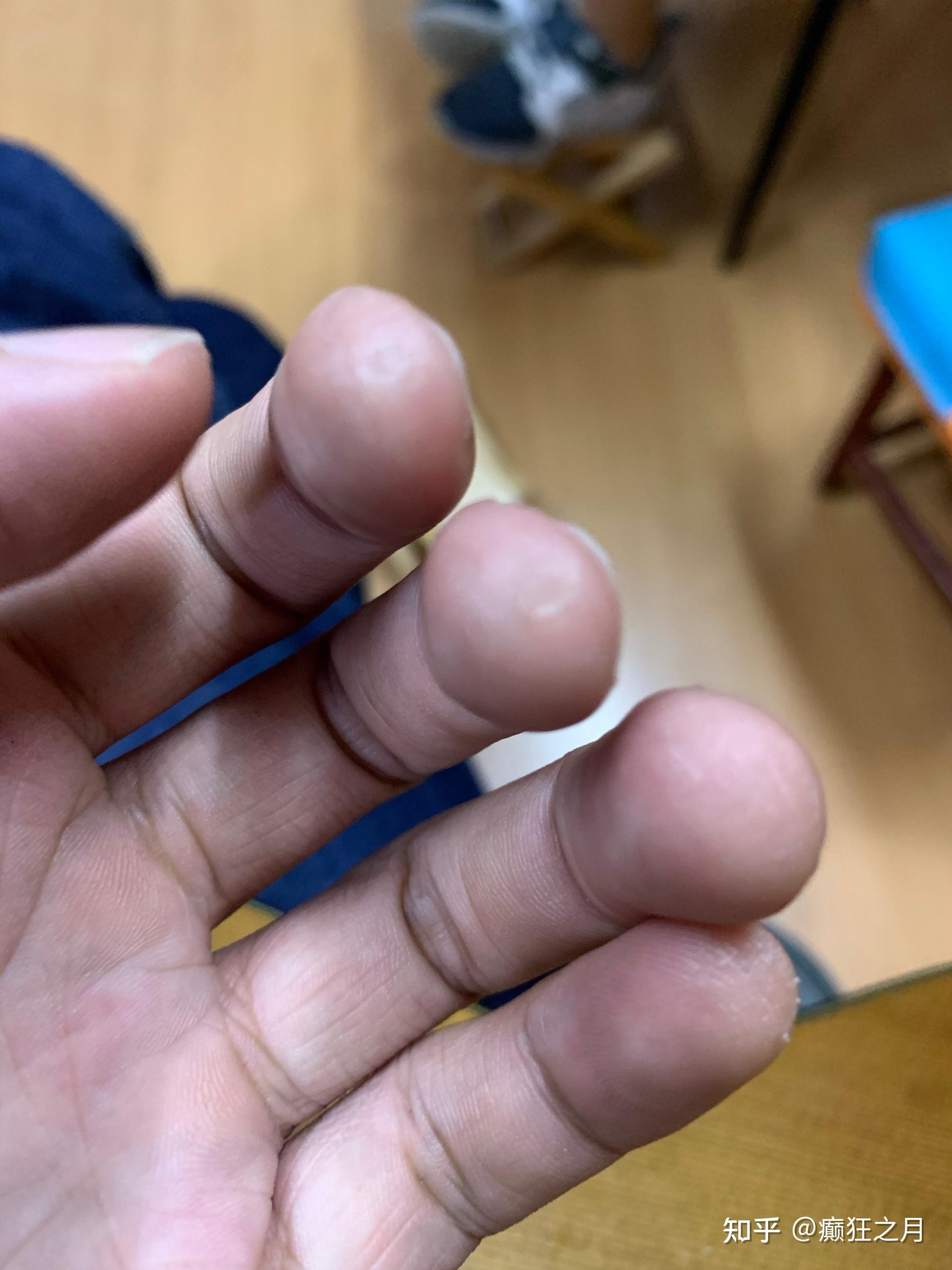 为什么我弹了四年吉他手上的茧子还是不平滑很容易出现杂音击勾弦也