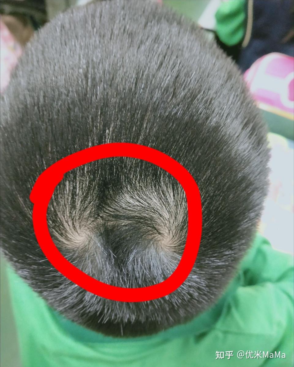 孩子头顶“几个旋”到底意味着什么?不少父母不懂,建议都看看 - 知乎