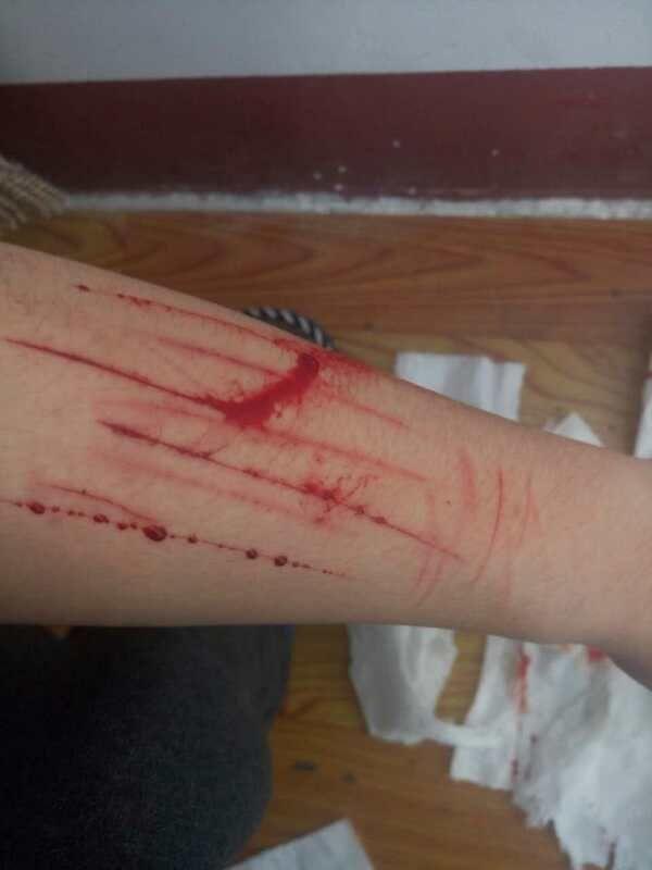 自残与心理疾病是否存在必然联系?