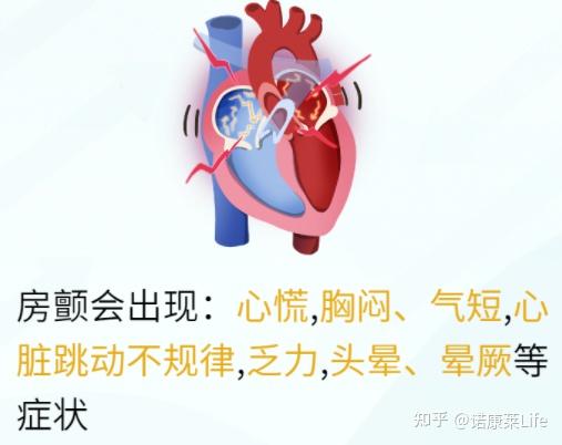 体检上房颤VS室颤有什么区别? - 知乎