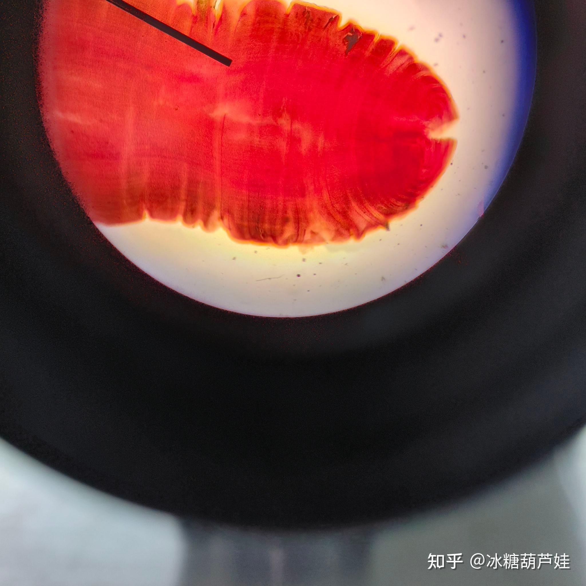 棘球蚴砂 3.曼氏迭宫绦虫裂头蚴 4.牛囊尾蚴 5.曼氏迭宫绦虫 6.