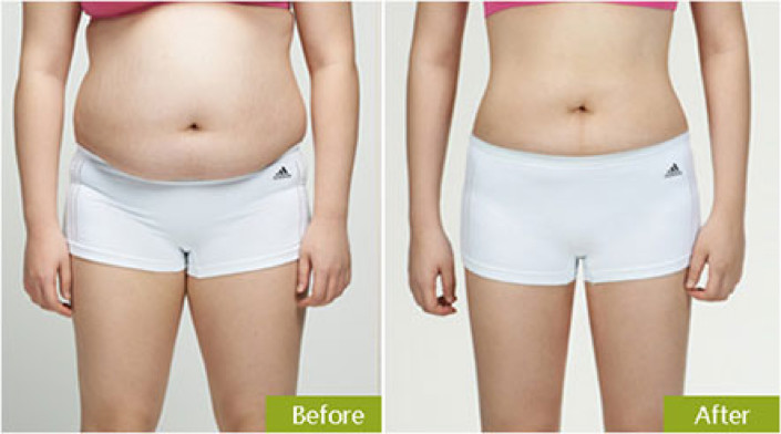 专减肚子的减肥新成分 知乎