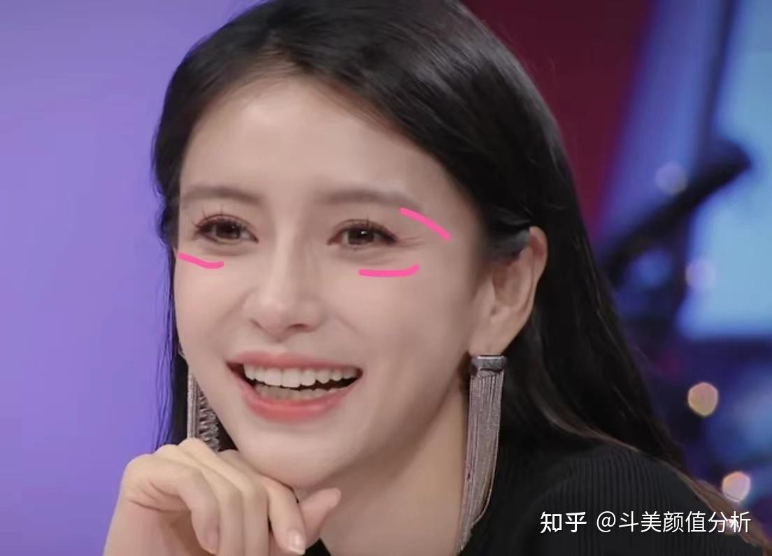 上海割眼袋的整形医院哪家做的比较好? - 知乎