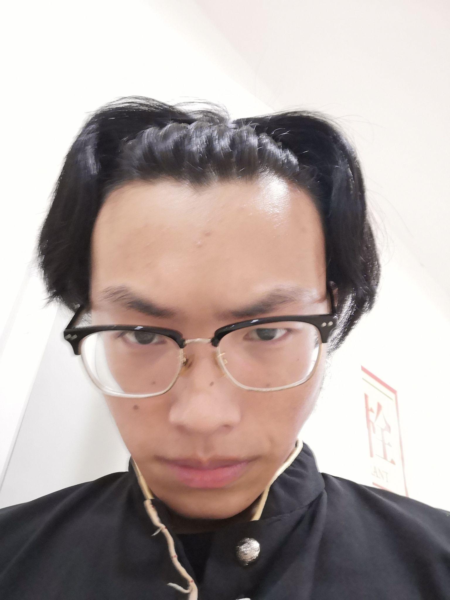 男生长得丑还留长发是什么体验?