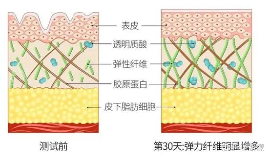 妊娠纹怎么淡化? - 知乎