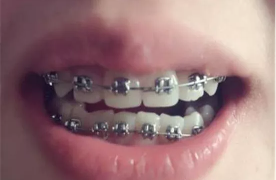 v2-888ae946f2da419394409114486deadf_1440w.jpg?source=172ae18b