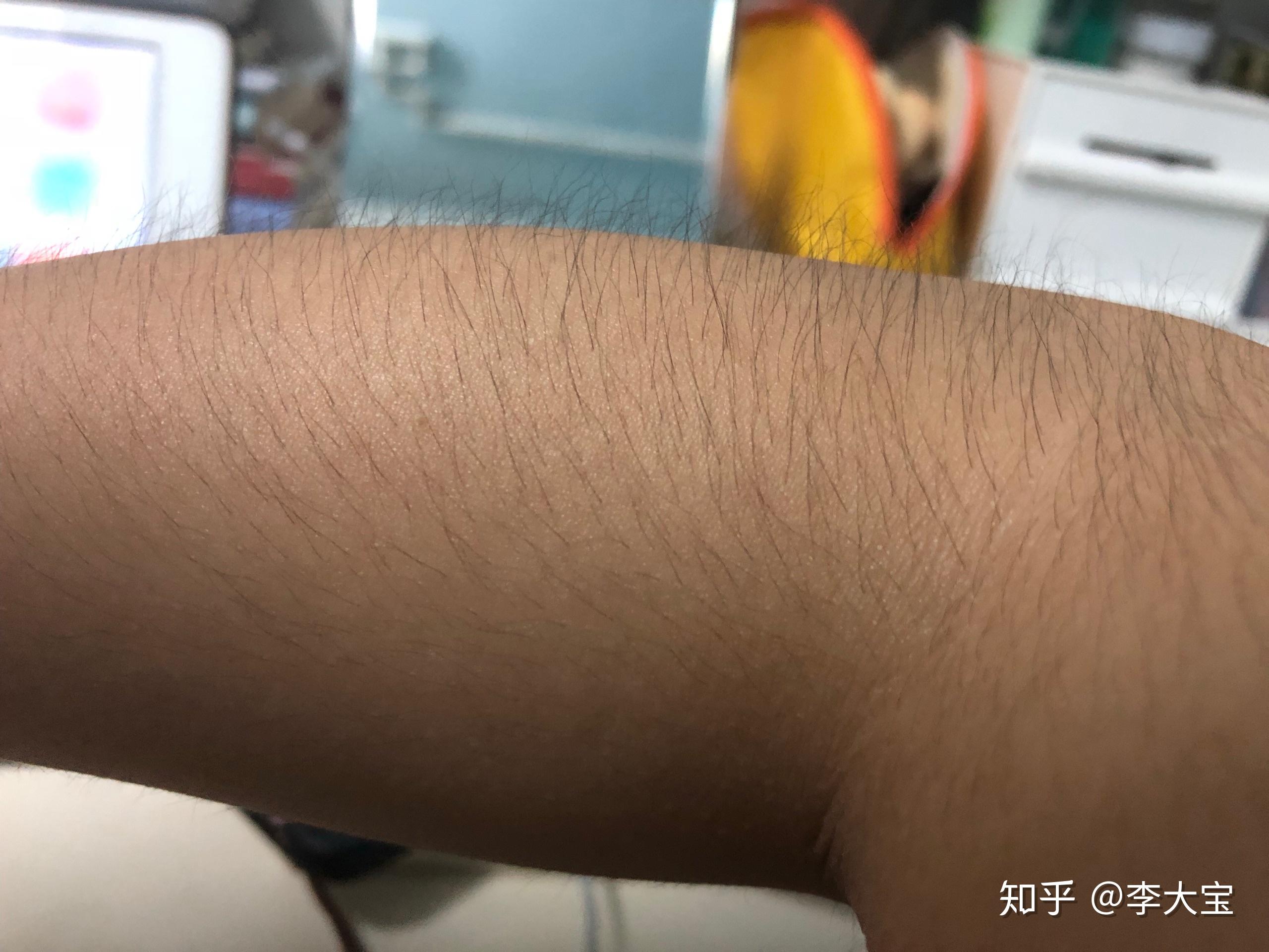 女生体毛旺盛是什么样的体验？ - 知乎