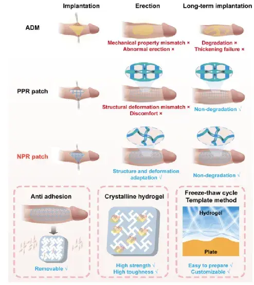 华南理工大学最新研究:一种用于阴茎增大的聚乙烯醇水凝胶新型补片!