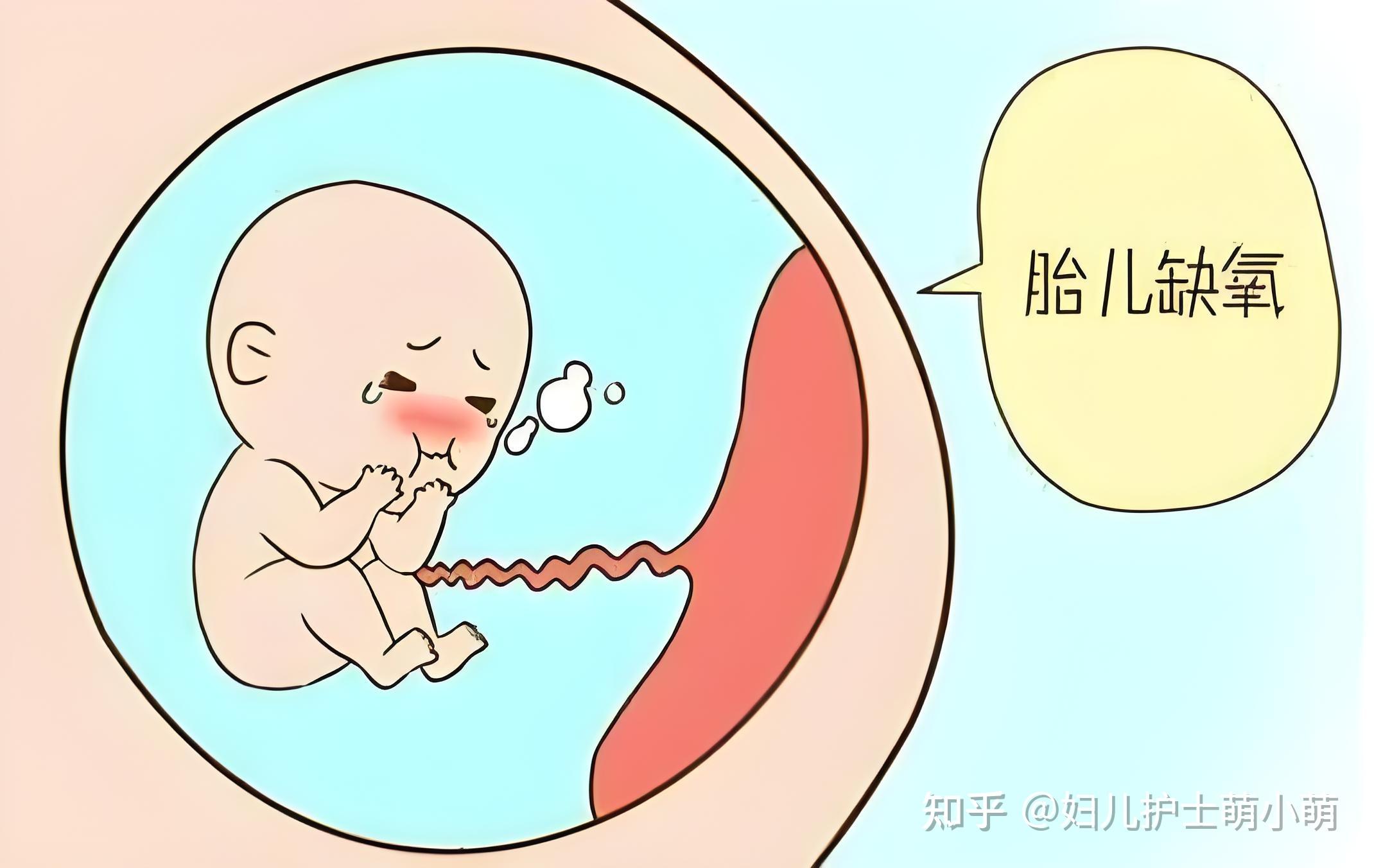 胎心的位置就是胎儿当前所在位置吗? - 知乎