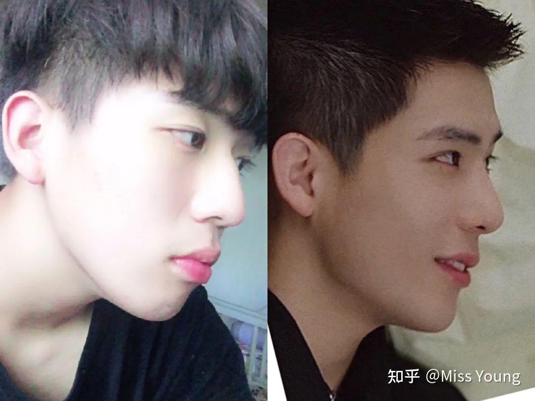 王安宇是不是整容了? - 知乎