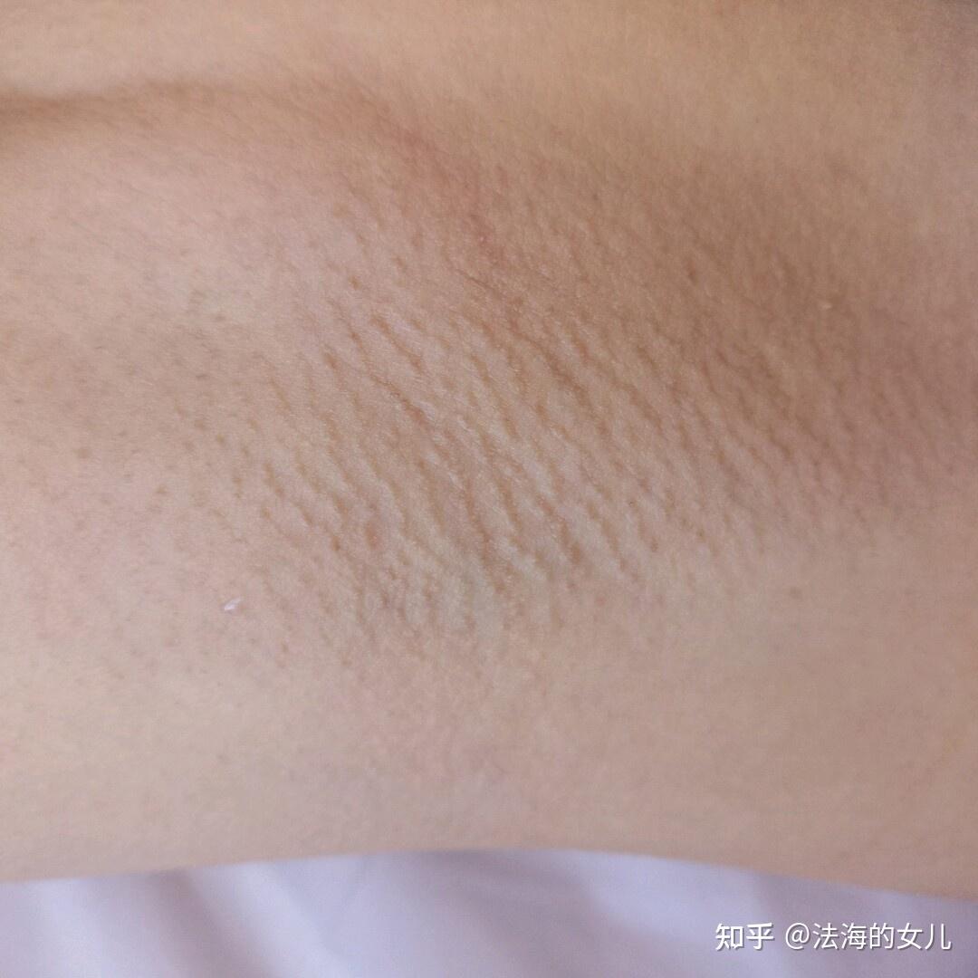 男生会介意女生腋窝处有一些腋毛吗?