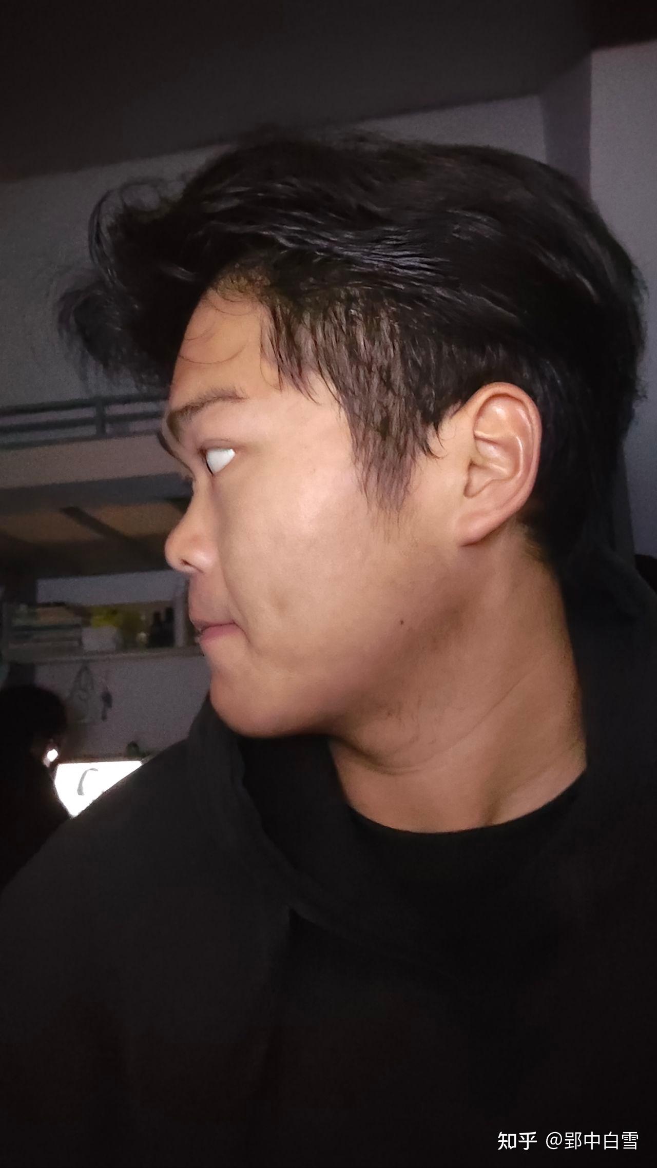 男性没有鼻梁鼻子塌的人是什么体验?