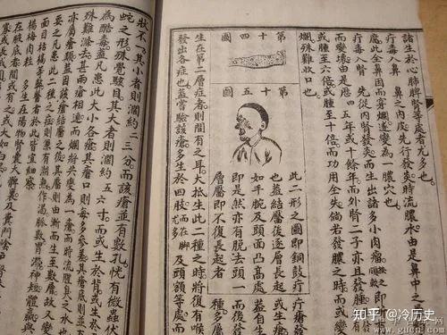 古代中国是否有性病,如梅毒、艾滋病等 - 知乎