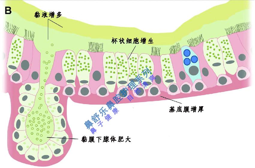 抠鼻屎如果不卫生不文雅，那大家都是怎么弄干净鼻屎的，尤其是干在鼻孔里的那些? - 知乎