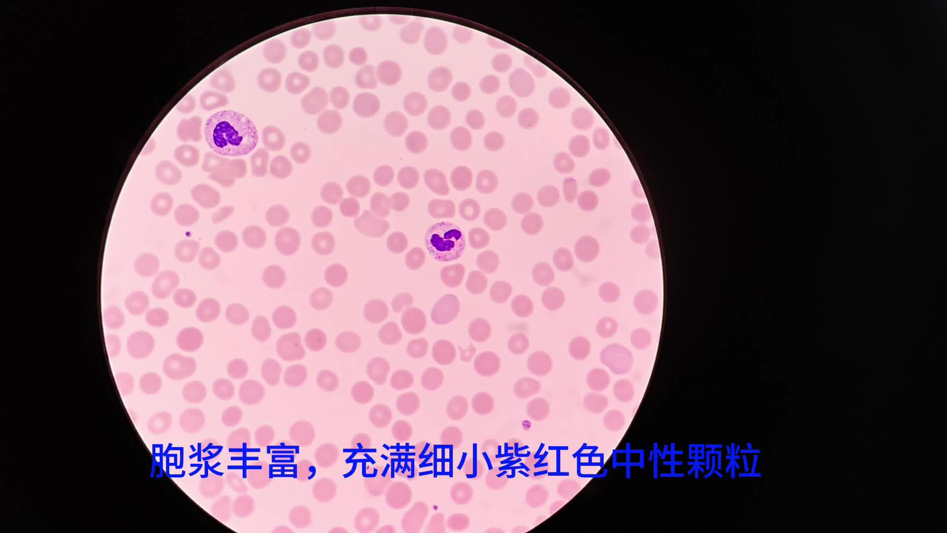 中性粒细胞在显微镜下的主要特征?在非特异性免疫应答中起什么作用?