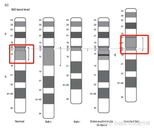 染色体倒位图片