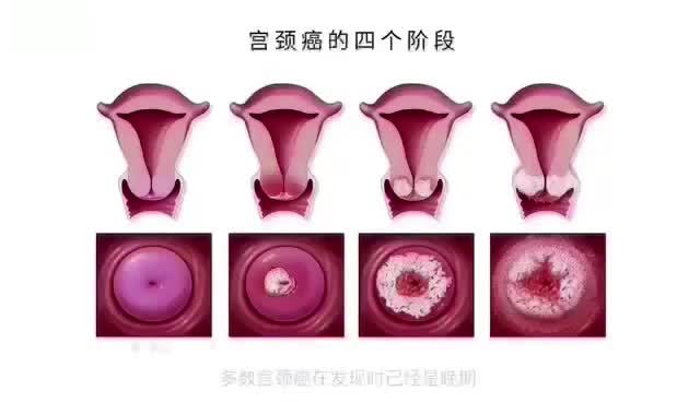 v2-8bcb421c08d925ce4c4b0ac6d4ce1745.jpg?source=382ee89a